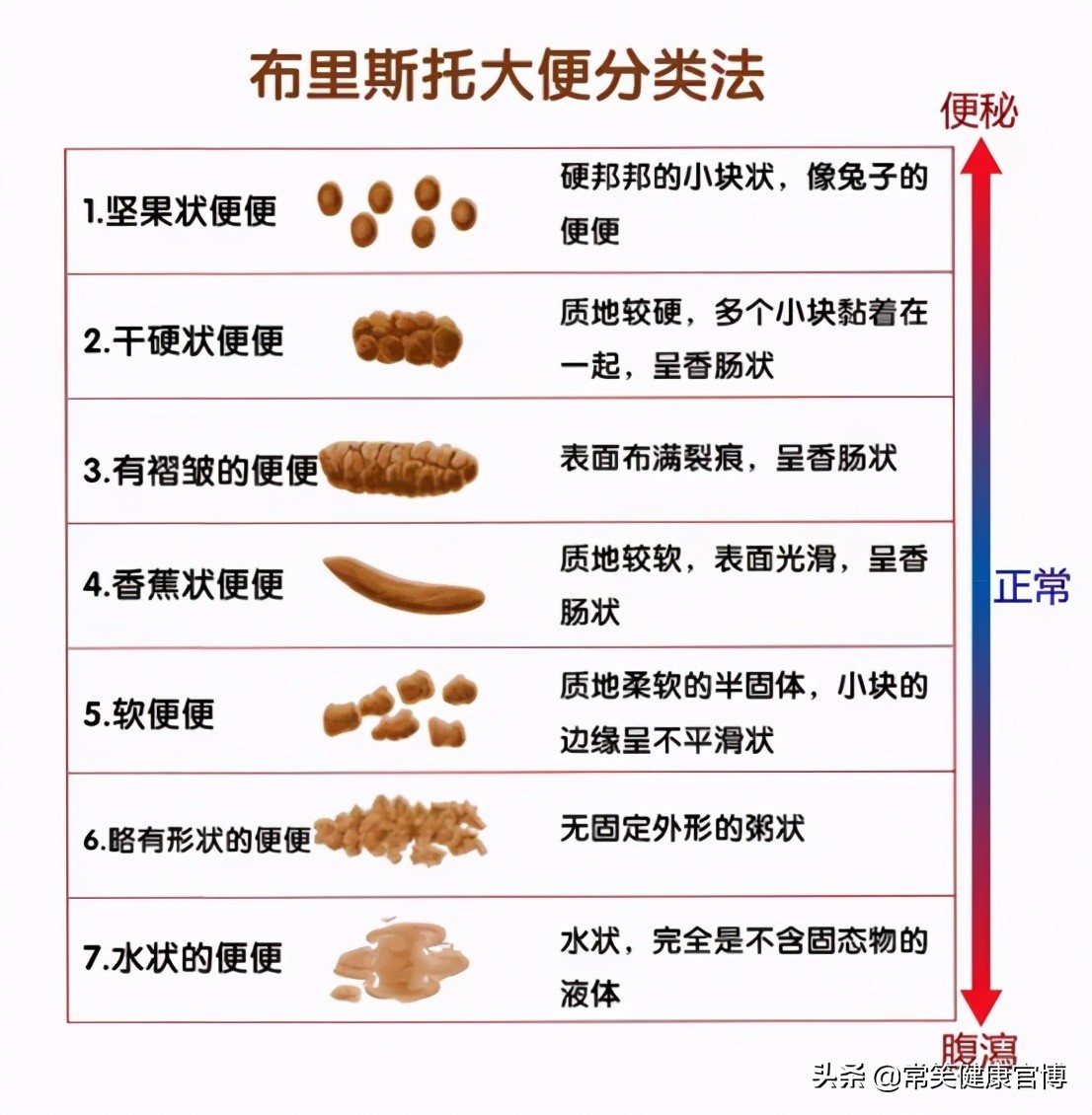 一次完美的拉屎是什么样子的？你很有可能不知道自己是不是便秘