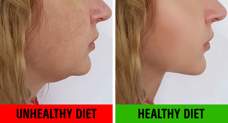 减少面部赘肉,减少面部双颊脂肪的医美项目