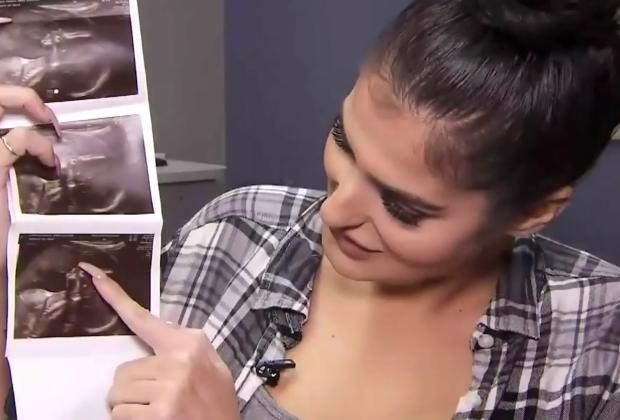 外国孕妇做b超被吓坏,国外孕妇生双胞胎检查结果图片