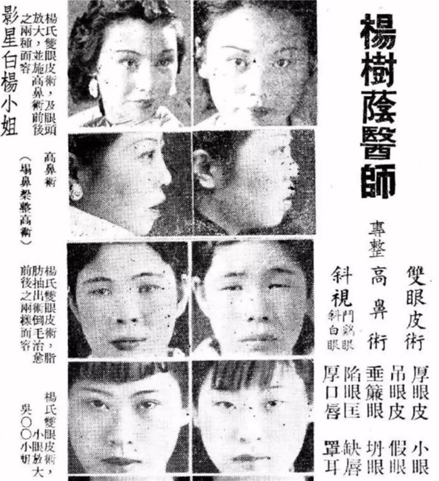 中国哪家整容医院割双眼皮好,上海哪家整容医院做双眼皮最好