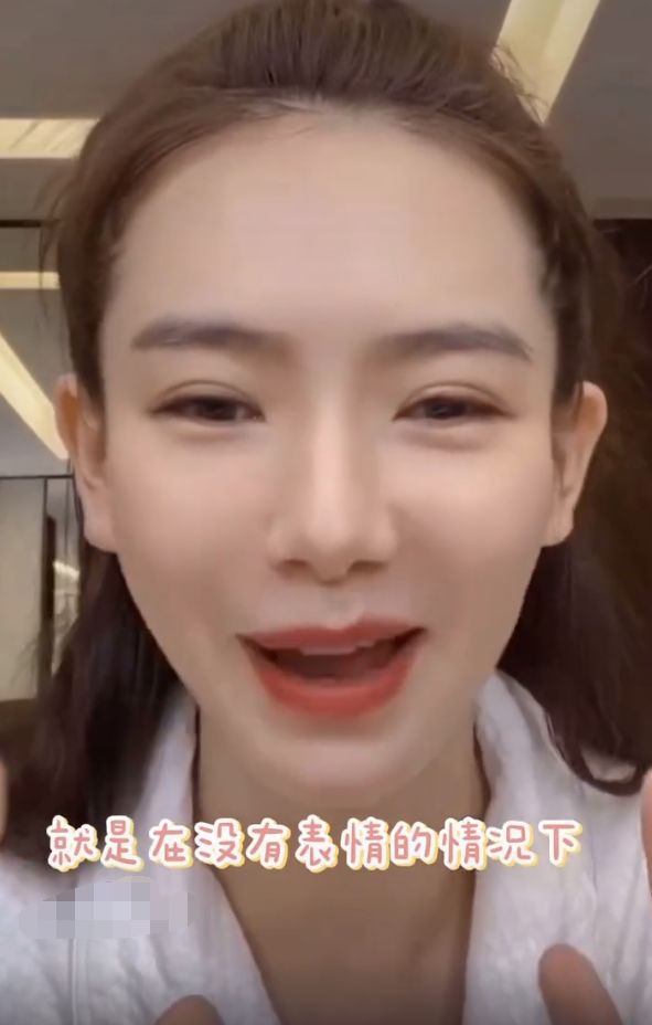 戚薇眼睛双眼皮前后,戚薇双眼皮前后对比照真实