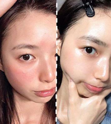 真正有效的芦荟胶,安全好用的芦荟胶