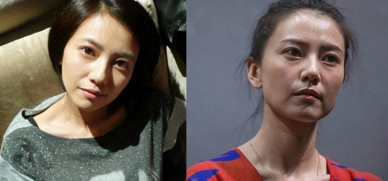 法令纹显老10岁三种方法帮助缓解,法令纹怎么消除4妙招告别衰老