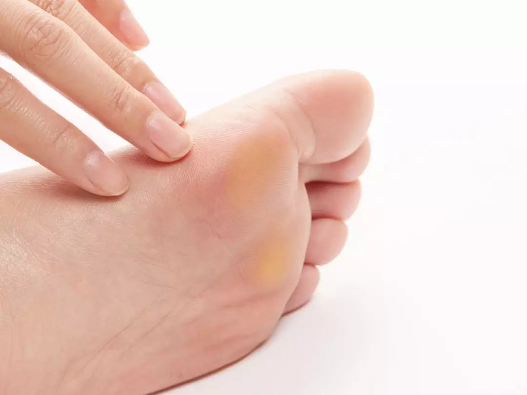 泡个脚出这么多汗怎么回事,磨脚神器去除厚老茧