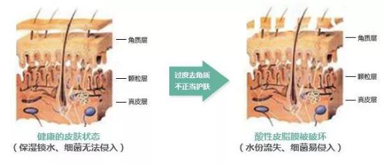 角质层薄适合的水,角质层过薄怎么办有什么方法