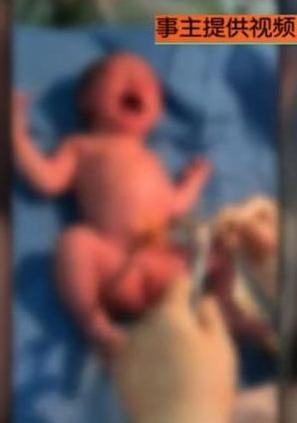 怀孕看见排骨会不会想吐,孕初期老是觉得饿也没有孕吐反应