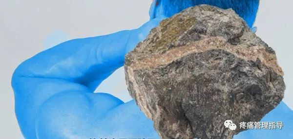 为什么天冷肩颈就痛起来,为什么天冷颈肩不舒服