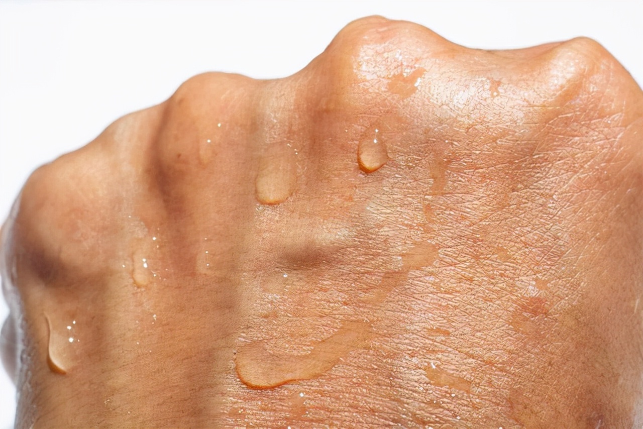 浓硫酸溅到脸上怎么最快恢复,当浓硫酸溅到眼睛或皮肤