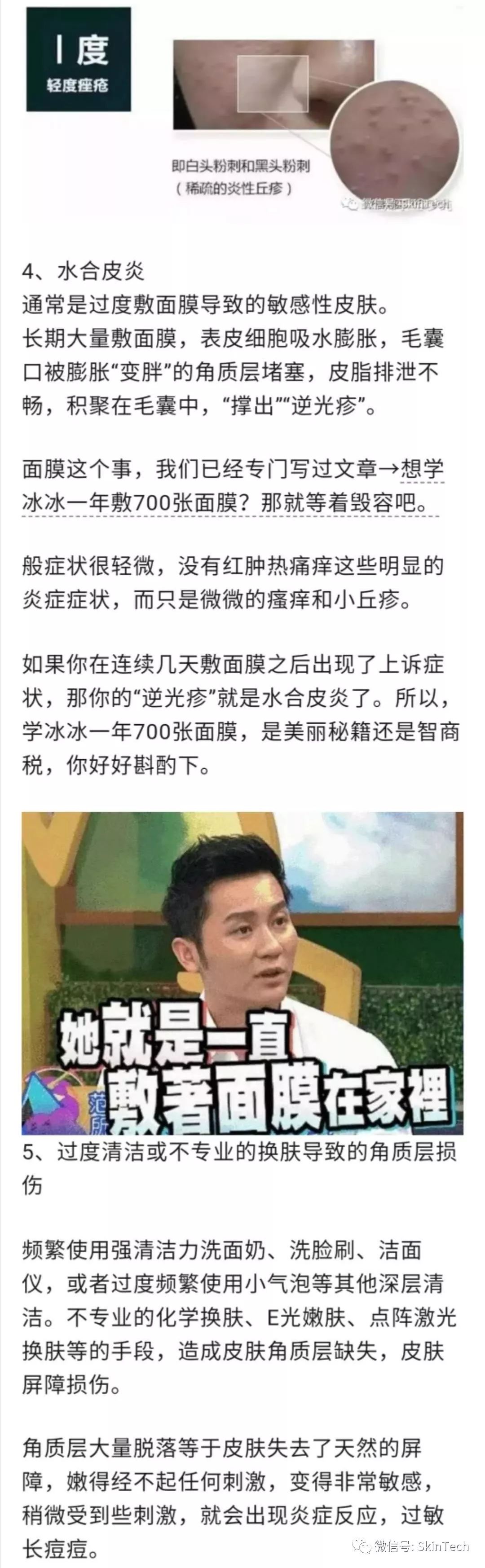 逆光疹是属于皮肤炎症吗,逆光疹是不是日光性皮炎