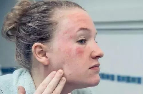 名门泽佳真假鉴别方法,名门泽佳防晒霜的使用方法