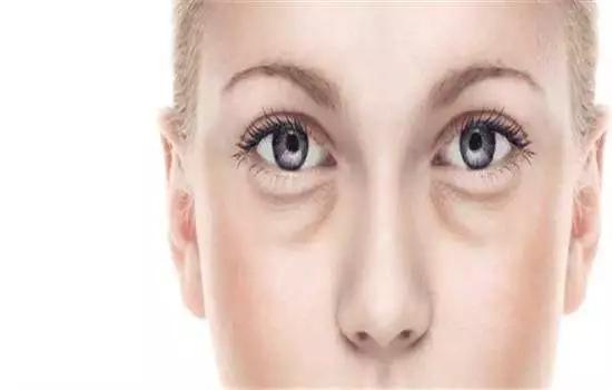 眼膜学生党去黑眼圈男生,眼膜男用