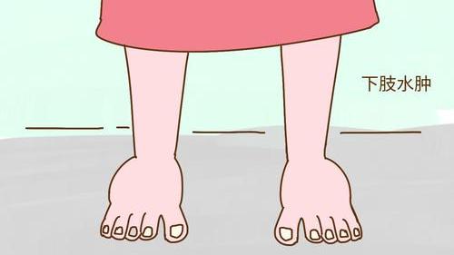 下肢水肿中医疗法,水肿的经典方剂