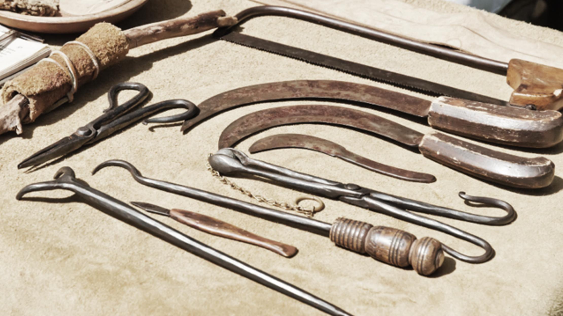 曾经的手术是一场噩梦吗,曾经的心脏手术