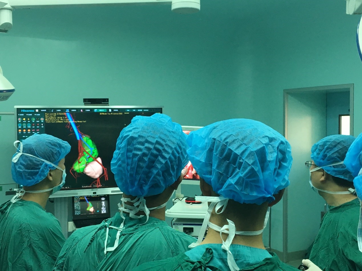 海信为何能取得如此快速的发展,海信最厉害的技术