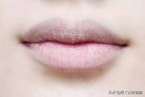 女性妇科皮肤病有哪些症状,女性常见的十大妇科疾病症状