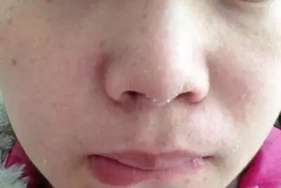 堪比科颜氏白泥的其他护肤品,堪比科颜氏精华