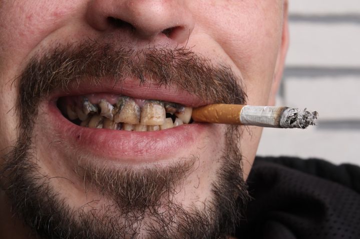 如何使黄牙齿变白的简单方法,牙齿黄怎么办变白小妙招视频