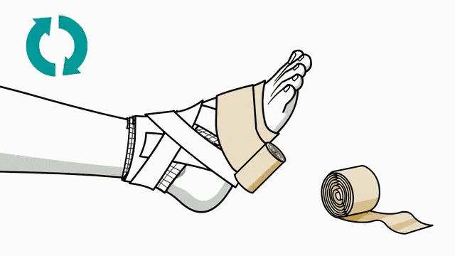 崴脚了用什么加压包扎,打篮球崴脚加压包扎