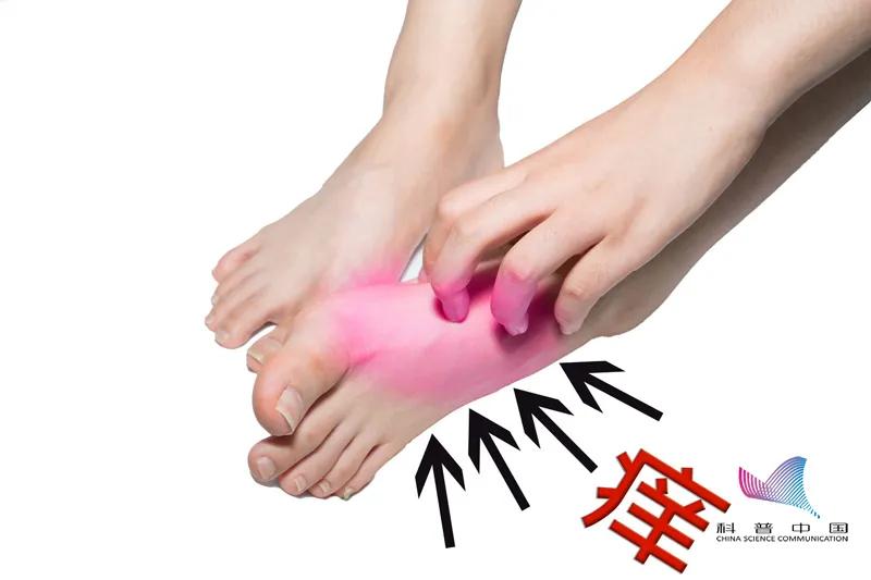 脚气抓痒后会传染到其他地方吗,被传染到了脚气特别痒还没有水泡