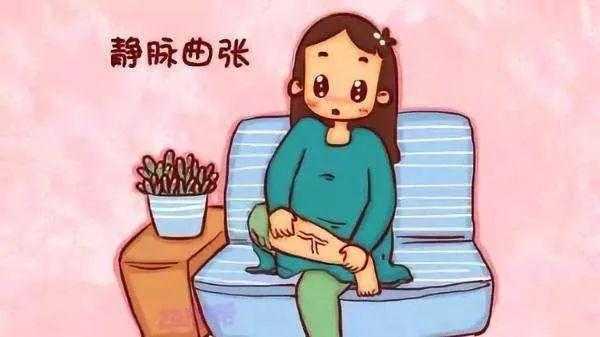 缓解静脉曲张的运动方法3种,缓解腿部静脉曲张最好的药