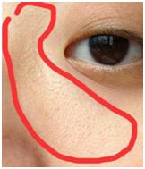 毛囊炎加鸡皮肤怎么根治,鸡皮肤和鱼鳞病怎样根治