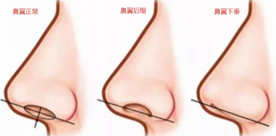 美之峰丁翔最新消息,长沙市美之峰医疗整形