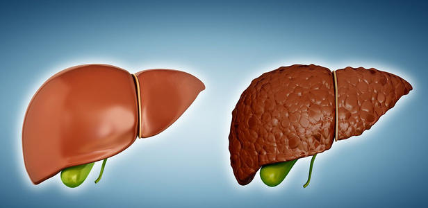 保肝药什么药最有效,保肝药有哪几种