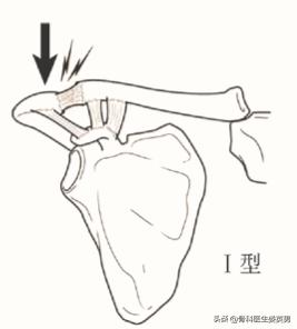 武磊左肩骨错位韧带撕裂,武磊首次回应左肩伤势