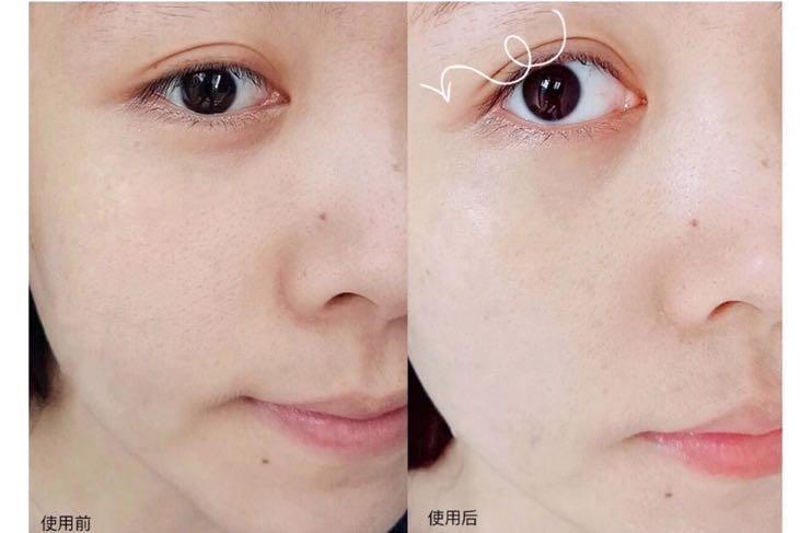 毛孔粗大有黑头适合什么粉底液,遮盖粗大毛孔黑头用什么粉底液