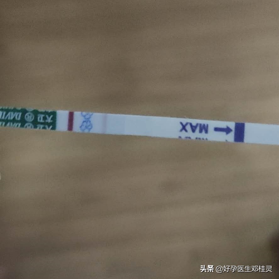 输卵管通而不畅盆腔粘连多囊卵巢,多囊加输卵管粘连可以自然受孕吗