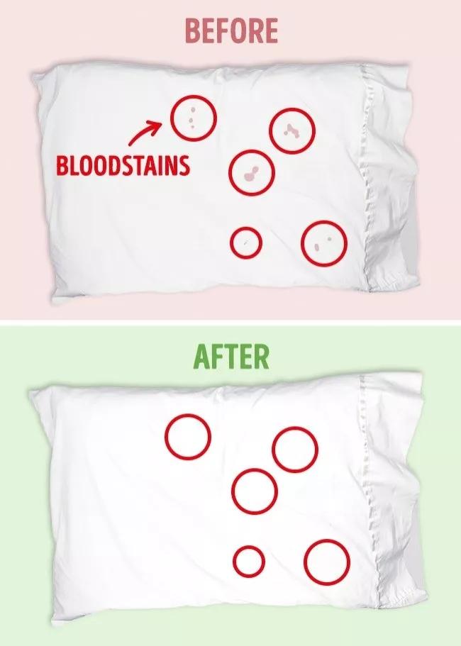 白色衣服发黄漂白剂洗得掉吗,衣服发黄怎么用漂白水