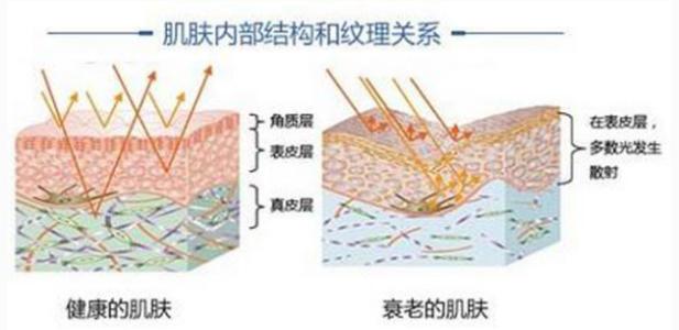 颈纹怎么消除显老,用什么方法去颈纹30年的颈纹最好