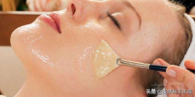 鼻子上挤出来黄色丝状物怎么解决,鼻子上挤出的白色状物到底是啥