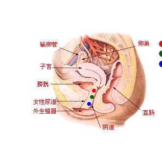 盆腔炎引起的腰痛,女生盆腔炎都会哪里疼