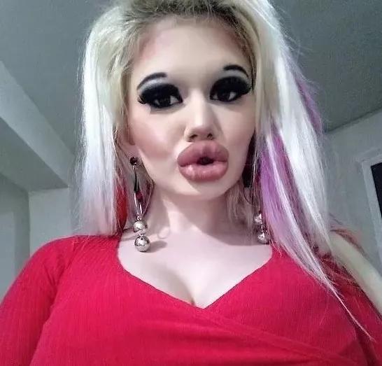 20次丰唇,20次整容成功的女人