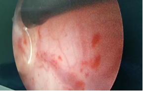 山东治疗泌尿外科比较好的医院,山东大学附属医院泌尿外科专家