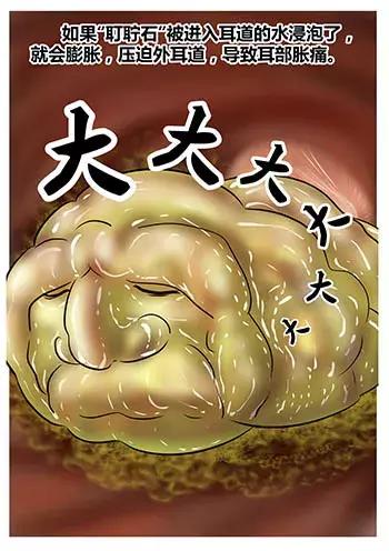 游泳耳朵里进水排不出来怎么办,游泳耳朵进水像堵了一层膜听不清