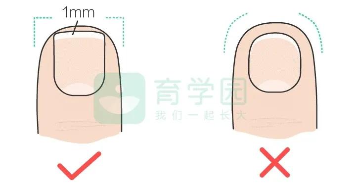 小孩指甲是什么样子才是健康,孩子指甲里有黑芯
