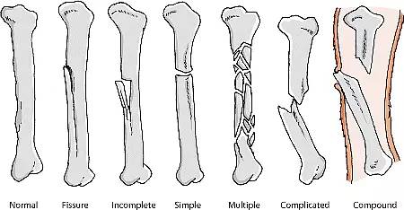 狗狗常见的意外事故及急救方法,狗狗意外伤人怎么治疗