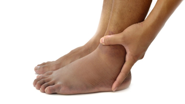 骨折手术后仍然不长怎么办,脚踝骨折手术肿多久才能彻底消肿