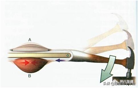 被动牵伸治疗的方法,牵伸治疗