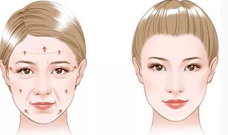 脸松弛除了拉皮和线雕有没有别的,脸颊松弛筋膜提升是线雕还是拉皮