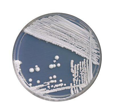 念珠菌中药调理方法,念珠菌用药几天止痒