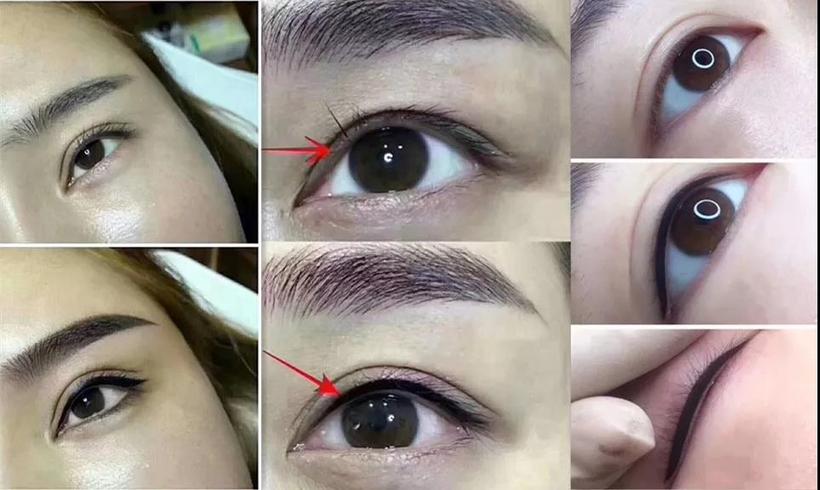 深圳传奇光学科技美容,深圳传奇光学祛斑仪器