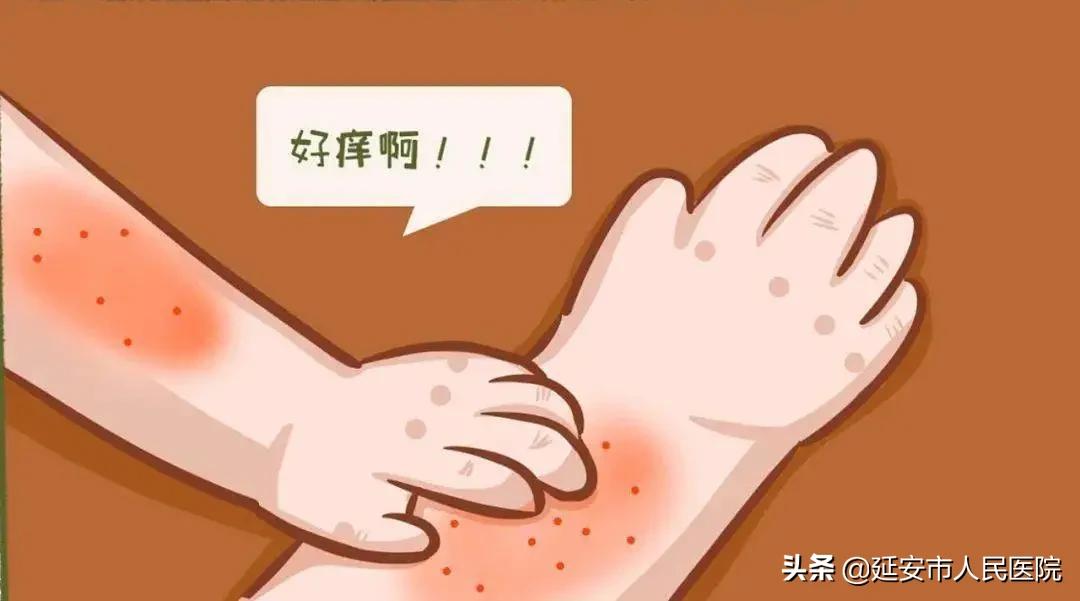 痒到怀疑人生的湿疹,到底该怎么办?