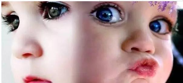 高度近视孕妈妈生产宝宝会近视吗,高度近视的准妈妈一定要剖宫产吗