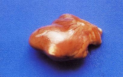 禽霉菌病,危害养禽业的细菌病