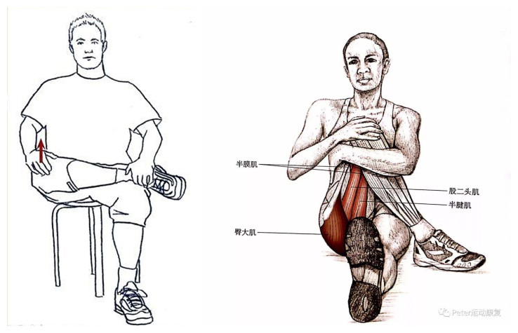 屁股痛、腿麻,有块肌肉受伤了