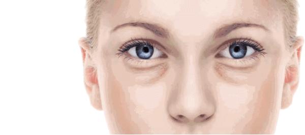 眼袋黑眼圈泪沟卧蚕的区别,有泪沟黑眼圈无眼袋卧蚕不见