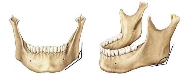 下颌角改善需要注意哪些方面,下颌角术后注意事项
